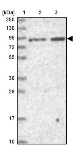 Ring finger protein 214 Antibody, Novus Biologicals 0.1mL; Unlabeled:Antibodies,